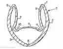 Fig. 01 - Contractable and expandable tubular wellbore system