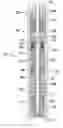 Fig. 01 - Release tool for coiled tubing