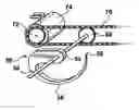 Fig. 01 - Sod pick-up mechanism