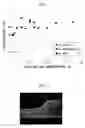 Fig. 02 - Method for laser welding steel sheets and composite material