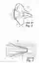 Fig. 02 - Probe for a body cavity