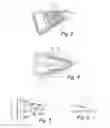 Fig. 03 - Probe for a body cavity