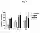 Fig. 05 - Method of pre-sensitizing cancer prior to treament with radiation and/or chemotherapy and a novel cytokine mixture