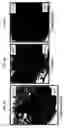 Fig. 13 - Methods and compositions for treating intervertebral disc degeneration