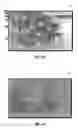 Fig. 22 - Methods and compositions for treating intervertebral disc degeneration