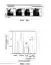 Fig. 22 - Hematopoietic stem cell gene therapy