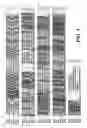 Fig. 02 - Surface proteins from gram-positive bacteria having highly conserved motifs and antibodies that recognize them