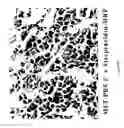 Fig. 06 - GBS toxin receptor antibodies