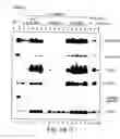 Fig. 19 - Methods for modulating hematopoiesis and vascular growth
