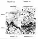 Fig. 02 - Methods of treating arthritis and diabetic retinopathy with αβ-specific antibodies