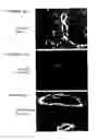 Fig. 06 - Methods of treating arthritis and diabetic retinopathy with αβ-specific antibodies