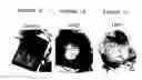 Fig. 08 - Methods of treating arthritis and diabetic retinopathy with αβ-specific antibodies
