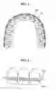 Fig. 02 - Orthodontic appliance by using a shape memory polymer