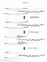 Fig. 02 - Method for depleting specific nucleic acids from a mixture