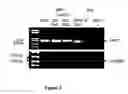 Fig. 04 - Use of JAG2 expression in diagnosis of plasma cell disorders