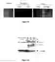 Fig. 05 - Use of JAG2 expression in diagnosis of plasma cell disorders