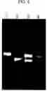 Fig. 07 - Multiplex PCR primer set for amplifying human MODY genes 1,4,5,6 and 7