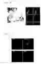 Fig. 06 - Methods of detecting megakaryocytes