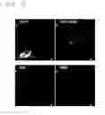 Fig. 08 - Methods of detecting megakaryocytes