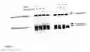Fig. 02 - Expression of lysosomal hydrolase in cells expressing pro-N-acetylglucosamine-1-phosphodiester α-N-acetyl glucosimanidase