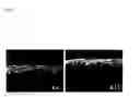 Fig. 07 - Ectocornea-like sheet and method of constructing the same