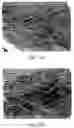 Fig. 22 - Methods and compositions for poly-beta-1-4-N-acetylglucosamine cell therapy system