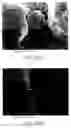 Fig. 44 - Methods and compositions for poly-beta-1-4-N-acetylglucosamine cell therapy system