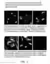 Fig. 02 - Kinesin inhibitors