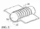 Fig. 05 - Medical implants and methods for regulating the tissue response to vascular closure devices
