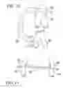 Fig. 08 - Medical implants and methods for regulating the tissue response to vascular closure devices