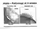Fig. 14 - Medical implants and methods for regulating the tissue response to vascular closure devices