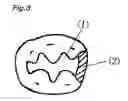 Fig. 03 - Composition for deodorization and decontamination of dental product