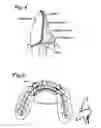 Fig. 04 - Composition for deodorization and decontamination of dental product