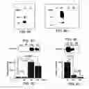 Fig. 08 - Novel type II Na/Pi cotransporters and type II Na/Pi cotransporter expression regulatory factors