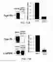Fig. 18 - Novel type II Na/Pi cotransporters and type II Na/Pi cotransporter expression regulatory factors