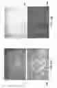 Fig. 27 - Novel type II Na/Pi cotransporters and type II Na/Pi cotransporter expression regulatory factors