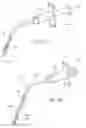 Fig. 22 - Devices, systems, and methods to fixate tissue within the regions of body, such as the pharyngeal conduit