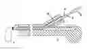 Fig. 01 - Endoscopic balloon insertion device for treatment of obesity and insertion technique of the same