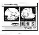 Fig. 03 - Planning and navigation assistance using two-dimensionally adapted generic and detected patient data