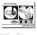 Fig. 06 - Planning and navigation assistance using two-dimensionally adapted generic and detected patient data
