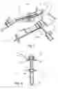 Fig. 03 - Method and device for the non-invasive assessment of bones