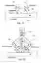 Fig. 09 - Method and device for the non-invasive assessment of bones