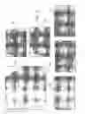 Fig. 04 - System, method and medium for generating operator independent ultrasound images of fetal, neonatal and adult organs