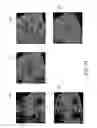 Fig. 12 - System, method and medium for generating operator independent ultrasound images of fetal, neonatal and adult organs