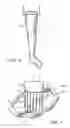 Fig. 04 - Medical socket contour scanning system