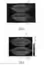 Fig. 04 - Method of comparing the appearance of a region of the human body at at least two different instants