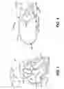 Fig. 03 - Method and apparatus for detecting ischemia