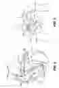 Fig. 04 - Method and apparatus for detecting ischemia