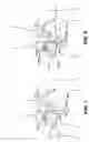 Fig. 05 - Method and apparatus for detecting ischemia