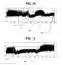 Fig. 12 - Method and apparatus for detecting ischemia